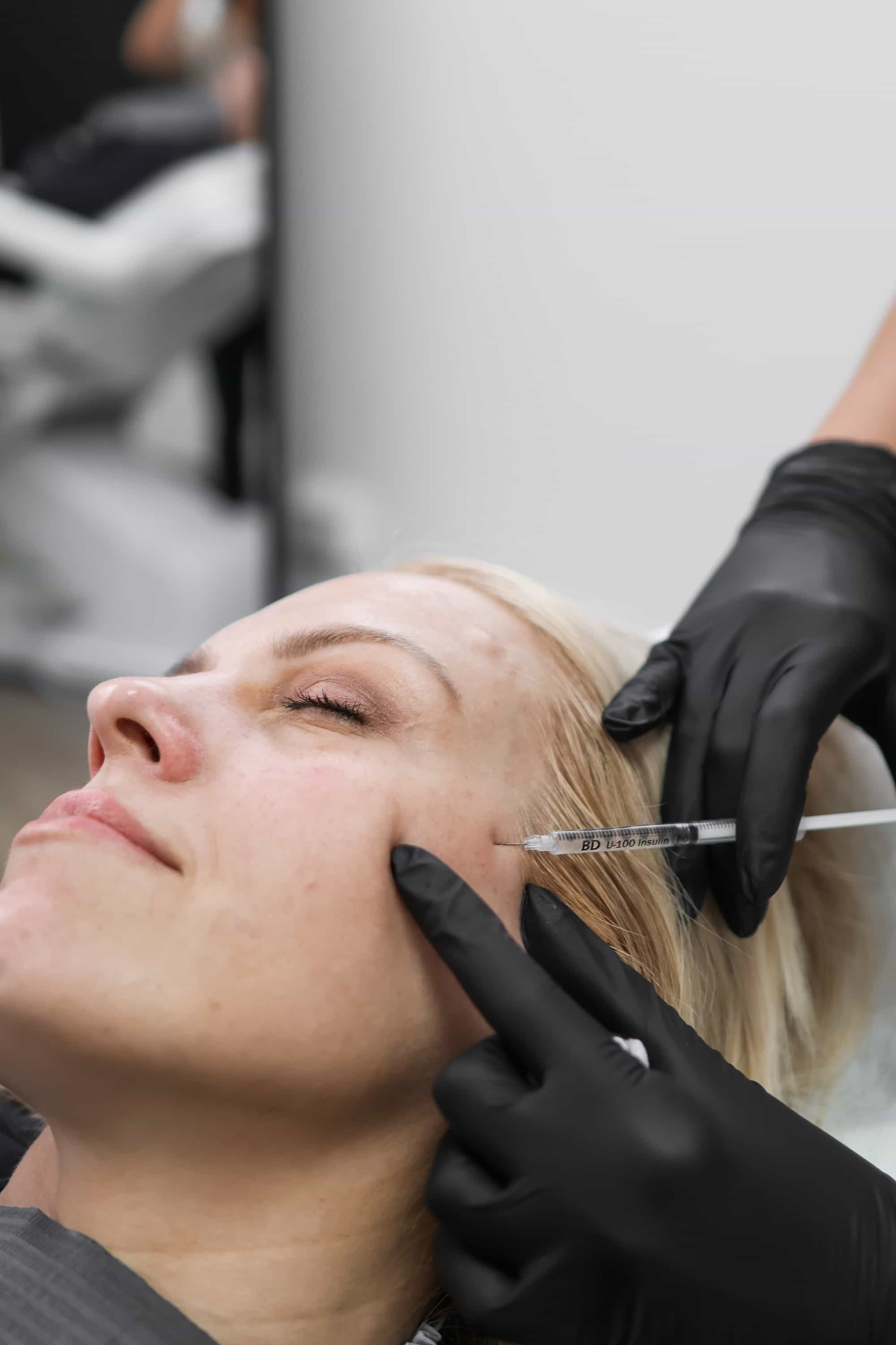 Sculptra in Surrey for Facial Rejuvenation and Collagen Boosting